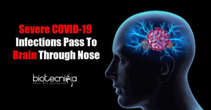 COVID-19 infects brain cells