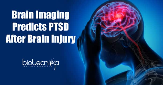 Predicting PTSD after Brain injury